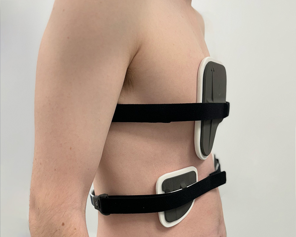 Side profile of patient wearing the dynamic chest compressor pectus brace and the rib flaring brace over the rib cage