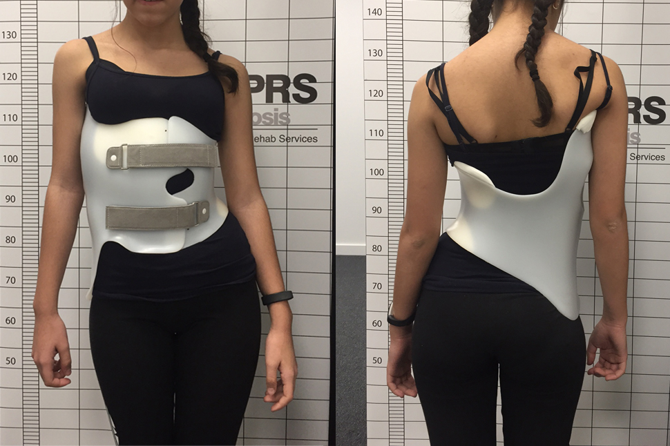 scoliosis back brace for adults