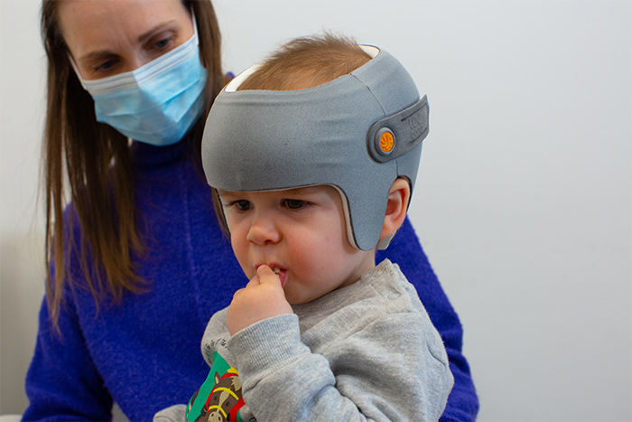 Baby during flat head syndrome fitting appointment