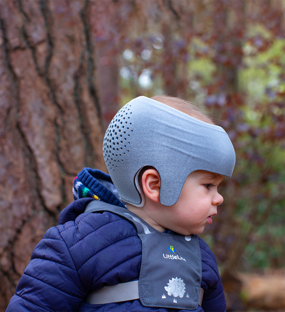 Plagiocephaly flat head syndrome 3D printed helmet LOCBand Lite