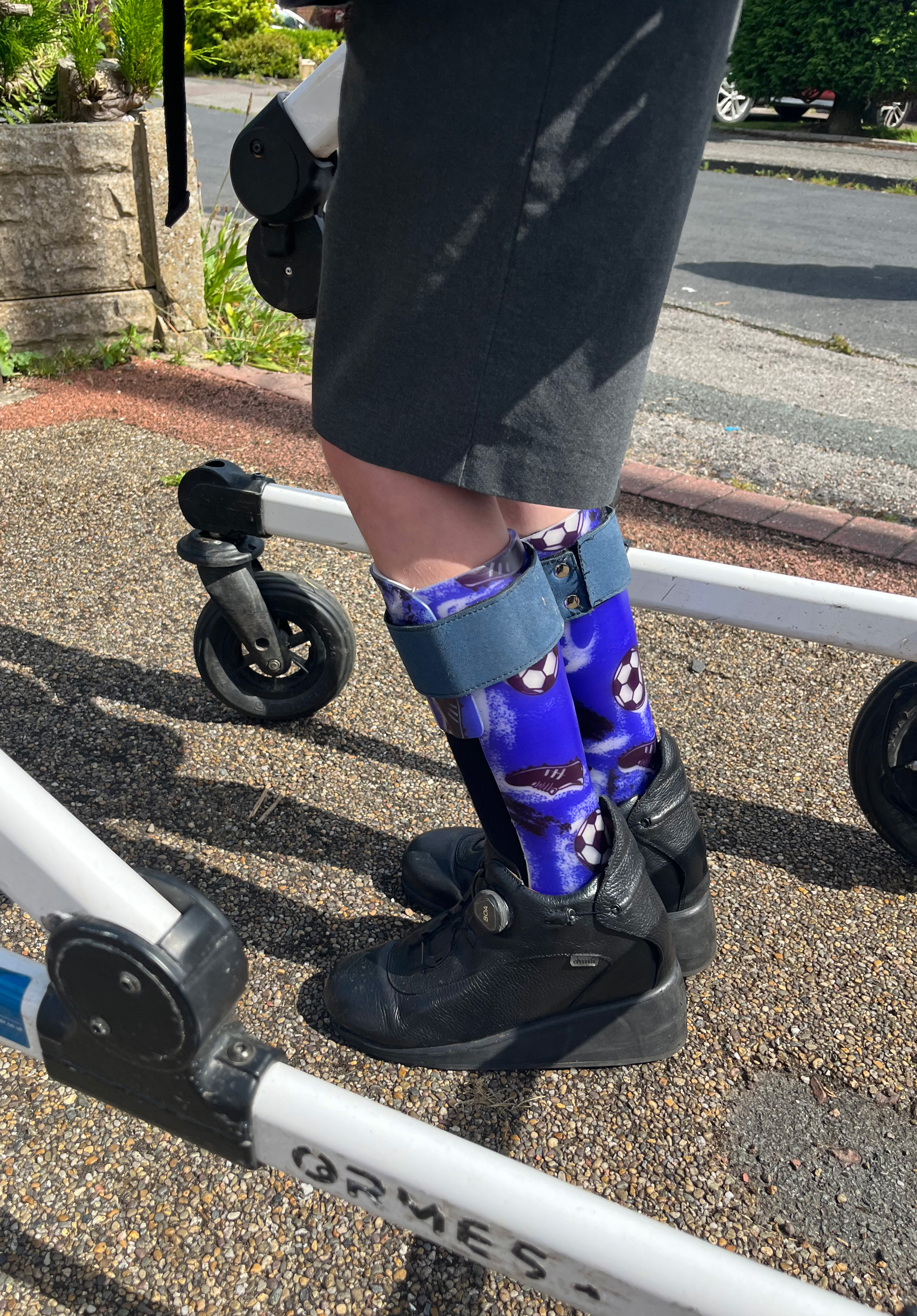 Bespoke Ankle Foot Orthoses for Cerebral Palsy patient