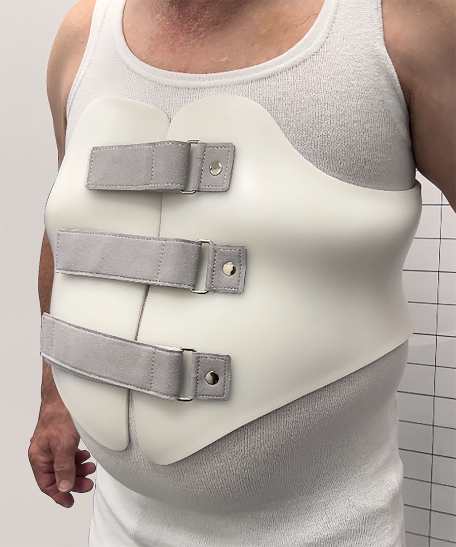 Multiple myeloma cancer patient bespoke spinal brace