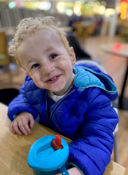 Child after completing helmet therapy with the LOCband