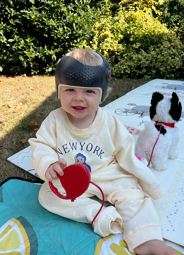 Baby in brachycephaly cranial remoulding helmet