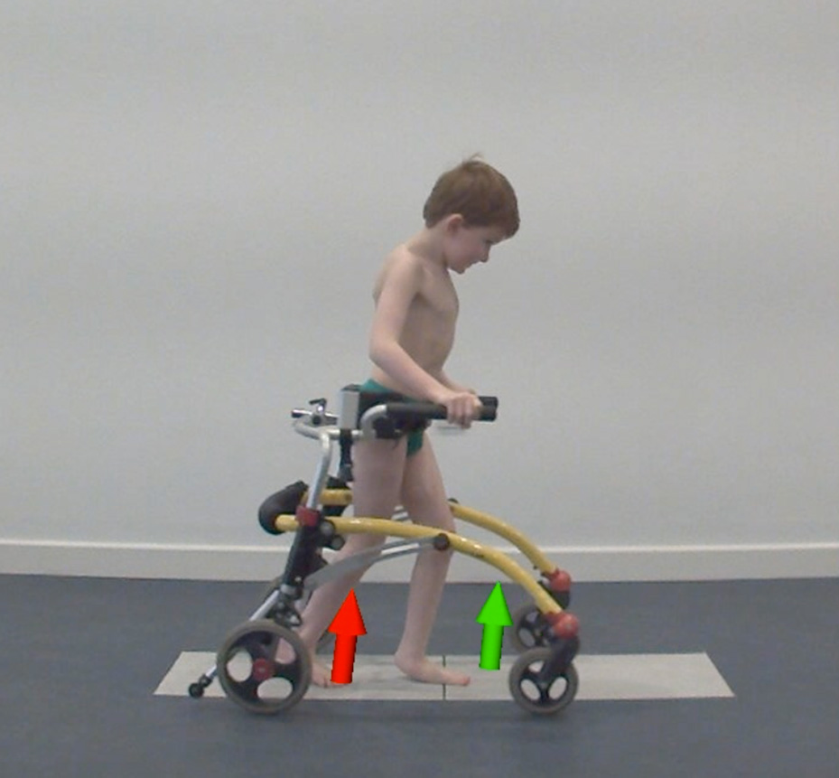 One of Archie's first appointments in the gait lab walking barefoot